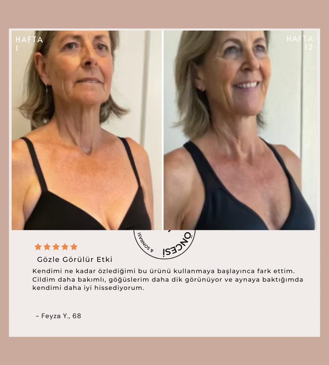 Göğüs Kırışıklık Karşıtı Serum